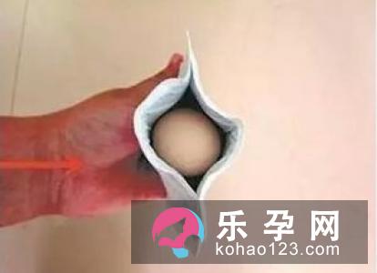 宝宝烫伤一般要用多长药 可以吃鸡蛋吗