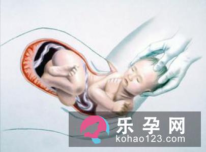 究竟选择哪种分娩方式好呢?