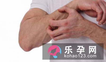 aveeno能治湿疹吗 价格多少钱