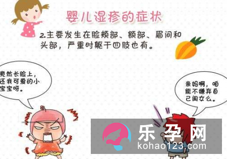 湿疹可以用炉甘石洗剂吗 使用注意事项