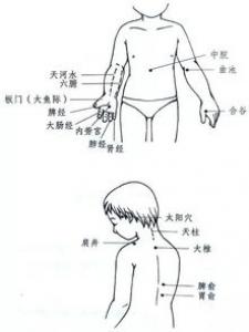 小儿暑热症是什么 症状有哪些