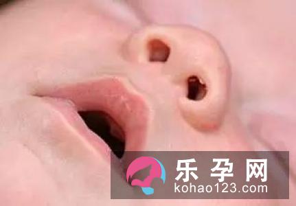 新生儿一放到床上就醒怎么回事 怎么防止掉床