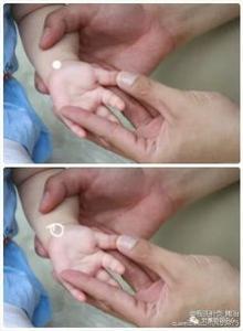 小儿推拿的操作顺序与部位 是推左手还是右手