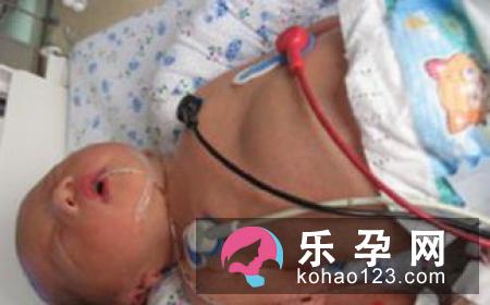 胎儿巨大儿是什么原因 长大后会正常吗