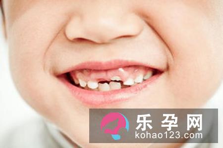 宝宝乳牙什么时候脱落 怎么处理