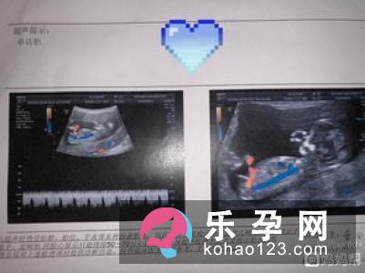 斯利安叶酸片饭前吃还是饭后吃 男人能吃吗