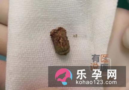 宝宝流鼻血去医院检查什么