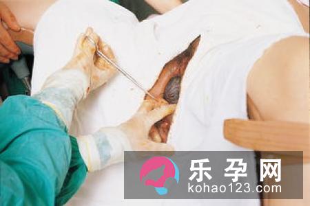 产妇在入院生产前就应选择好生产方式,医生会提前向产妇分析其适合选择的分娩方式
