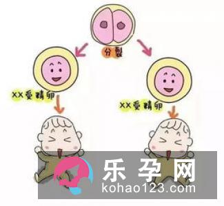开春备孕顺利怀上双胞胎