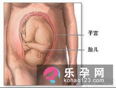 剖腹产真的比自然产安全？