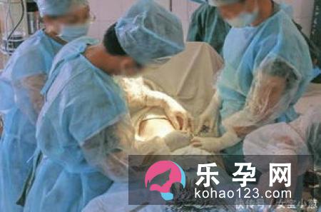 为避“无春年”选择早剖腹