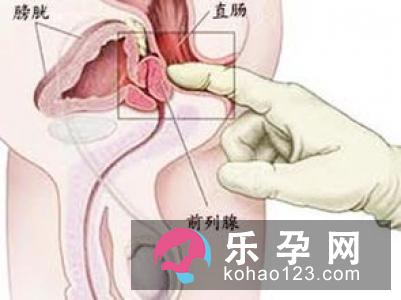 巴氏腺囊肿影响月经吗 如何预防