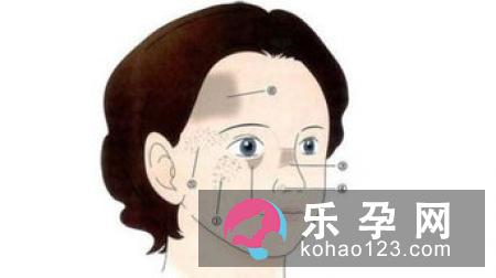 青色胎记的治疗方法 去除后如何护理