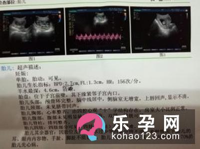 唐氏筛查的结果看男女性别可信吗