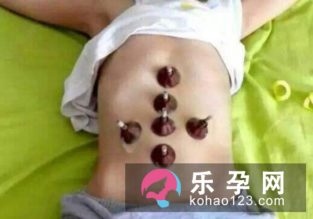 小孩艾灸会上火吗 什么原因引起的