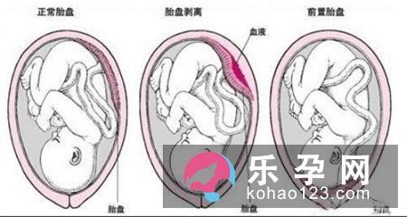 孕妇梦见捡花生是什么意思 是生男生女