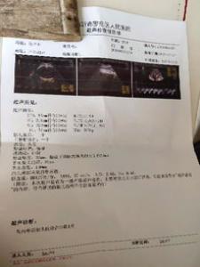 宝宝预产期不是出生日期怎么办