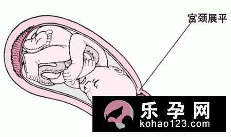 整个分娩过程的详细介绍