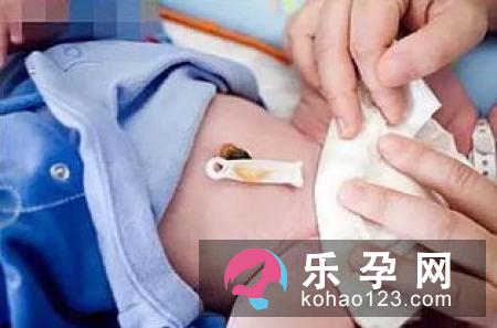 晚剪脐带2分钟有利婴儿健康