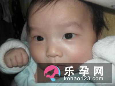 生完宝宝掉头发正常吗 掉头发厉害怎么办