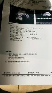 中医是如何看待生男生女的