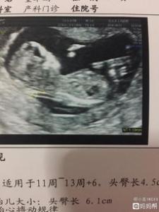 斯利安叶酸片饭前吃还是饭后吃 男人能吃吗