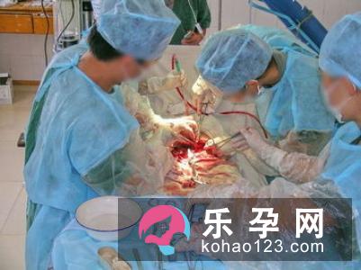 如何预防产后出血?-家居装修问答