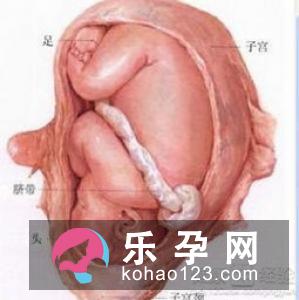 羊水早破自行紧急处理的方法