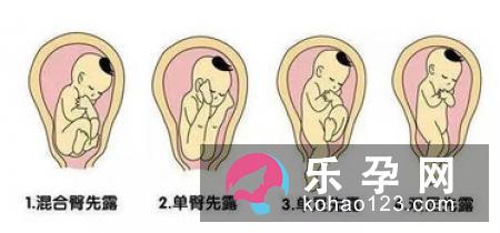 生产课堂：分娩该择日还是该撞日