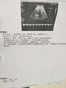 宝宝预产期不是出生日期怎么办
