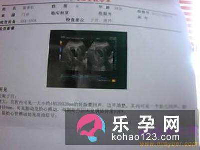 全面分享决定生男生女的秘密