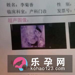 四维彩超心脏有强光点怎么办 算预产期准吗