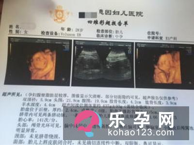 四维彩超心脏有强光点怎么办 算预产期准吗