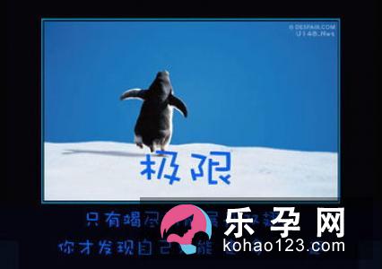 无痛分娩需要麻醉科配合