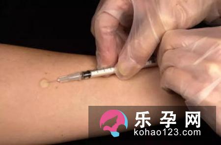 宝宝打百白破疫苗的地方红肿发硬是怎么回事 怎么办