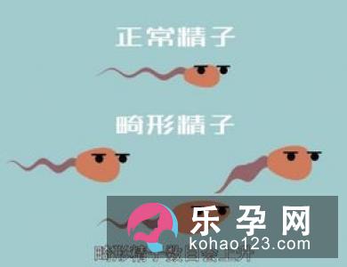 备孕须知 7种状态生男娃