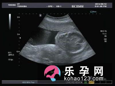 必须了解的8个胎盘要点