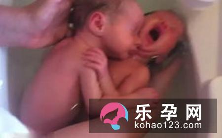 宝宝烫伤要打破伤风吗 多久能洗澡