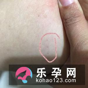 催生针打了以后多久生 对胎儿有影响吗