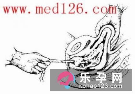 科学来解释错误分娩观
