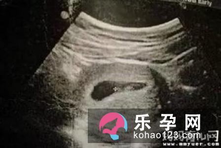 生男生女真的有办法吗