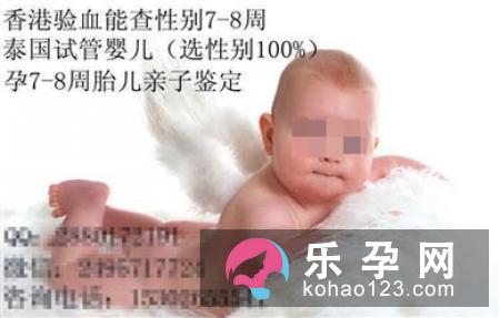 孕妇喜吃酸和胎儿性别无关