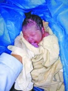 孕妇突遇分娩该如何急救
