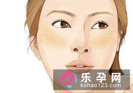 孕斑的形成原因是什么 如何预防