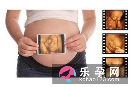 二维彩超有什么注意事项?