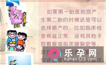顺还是剖应根据产妇身体决定