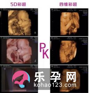 四维彩超有什么作用 和黑白B超的区别