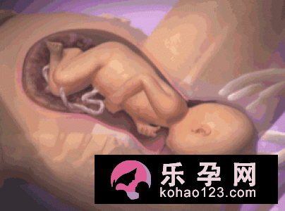 过期妊娠易难产 并发症也增加