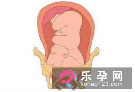 胎儿入盆后妈妈应该做什么