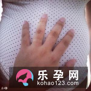 民间8招辨别胎儿性别准不准？